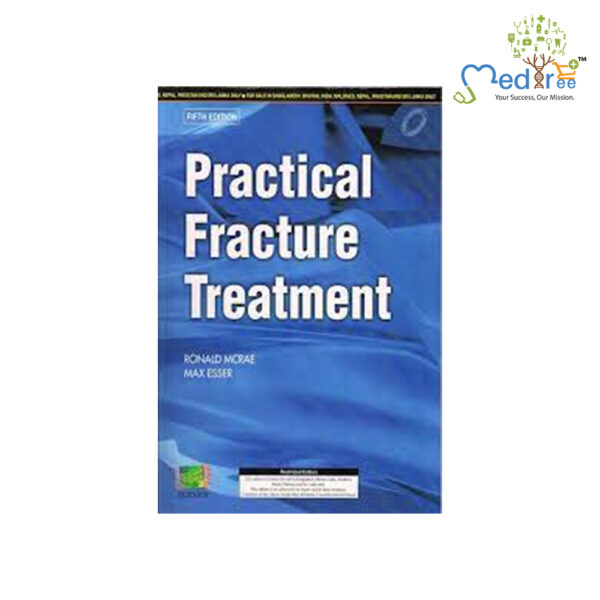 Practical Fracture Treatment, International Edition, 5e