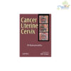 Cancer Uterine Cervix