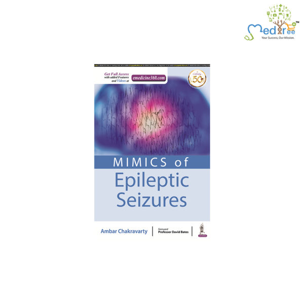 Mimics of Epileptic Seizures