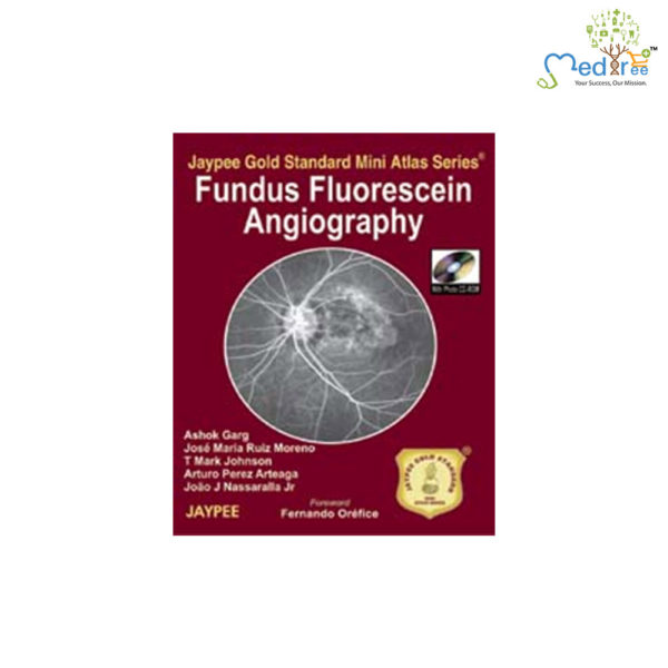 Jaypee Gold Standard Mini Atlas Series Fundus Flourescein Angiography (with Photo CD-Rom)