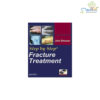 Step by Step Fracture Treatment (with Photo CD-ROM)