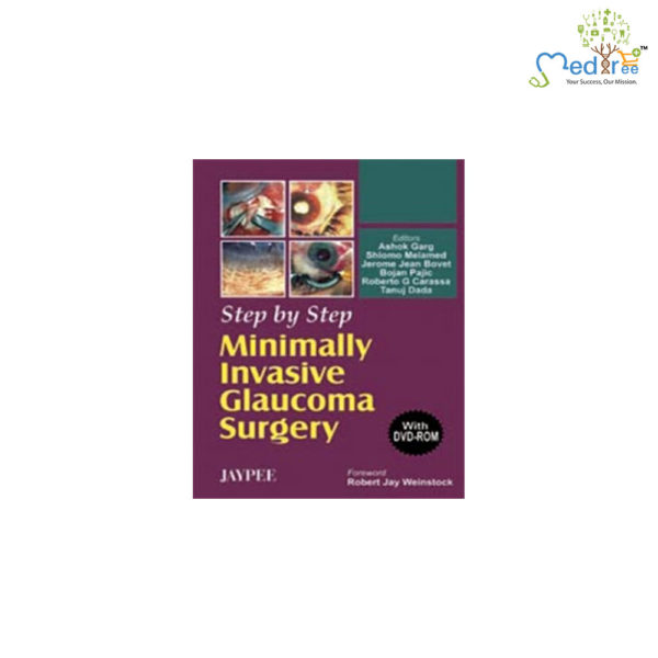 Step by Step Minimally invasive Glaucoma Surgery (with DVD-ROM)