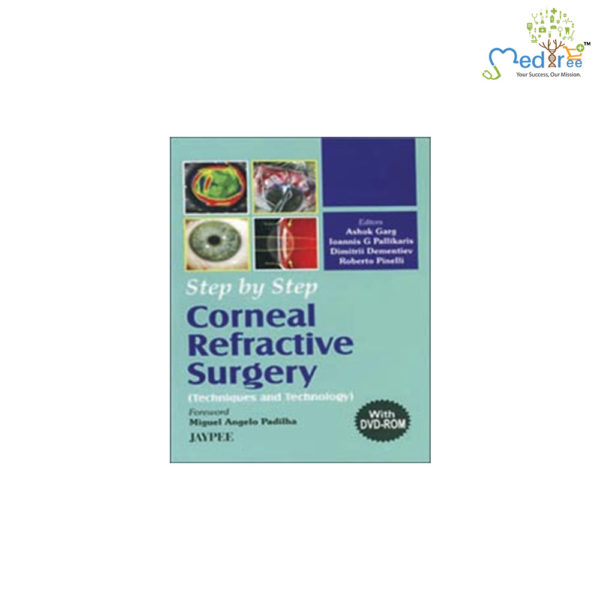 Step by Step Corneal Refractive Surgery (with DVD-ROM)