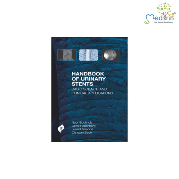 Handbook of Urinary Stents
