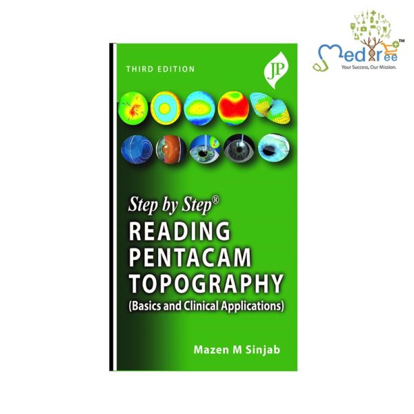 Step by Step Reading Pentacam Topography(Basics and Clinical Applications)
