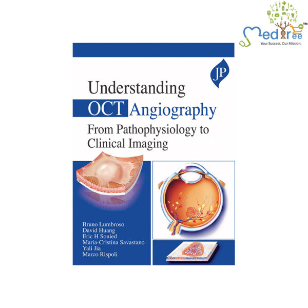 Understanding OCT Angiography From Pathophysiology to Clinical Imaging