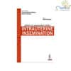 Infertility Management Series: Intrauterine Insemination