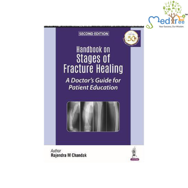 Handbook on Stages of Fracture Healing : A Doctor's Guide for Patient Education