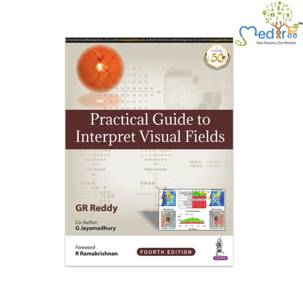 Practical Guide to Interpret Visual Fields