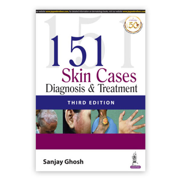 151 Skin Cases: Diagnosis & Treatment